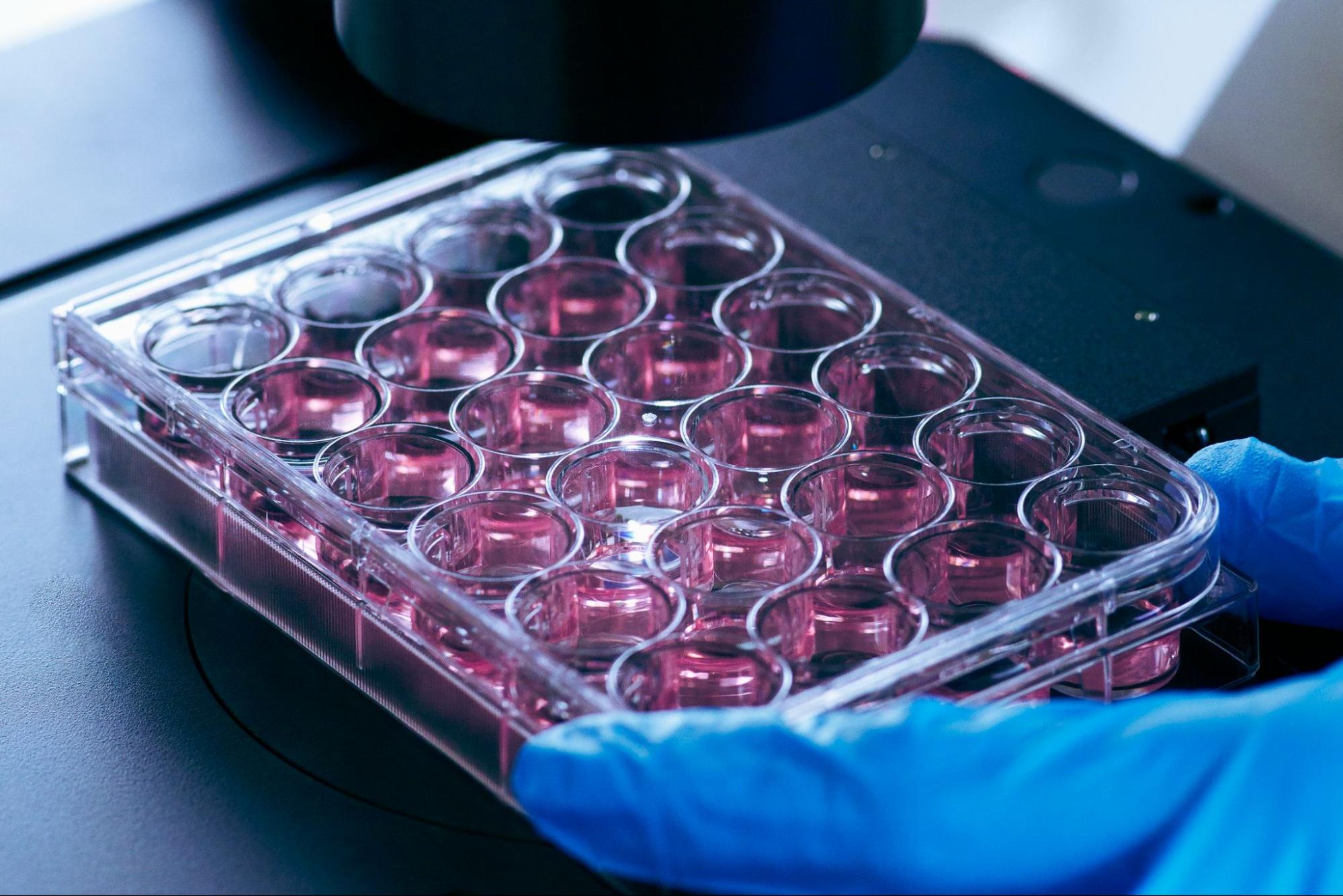 เก็บสเต็มเซลล์