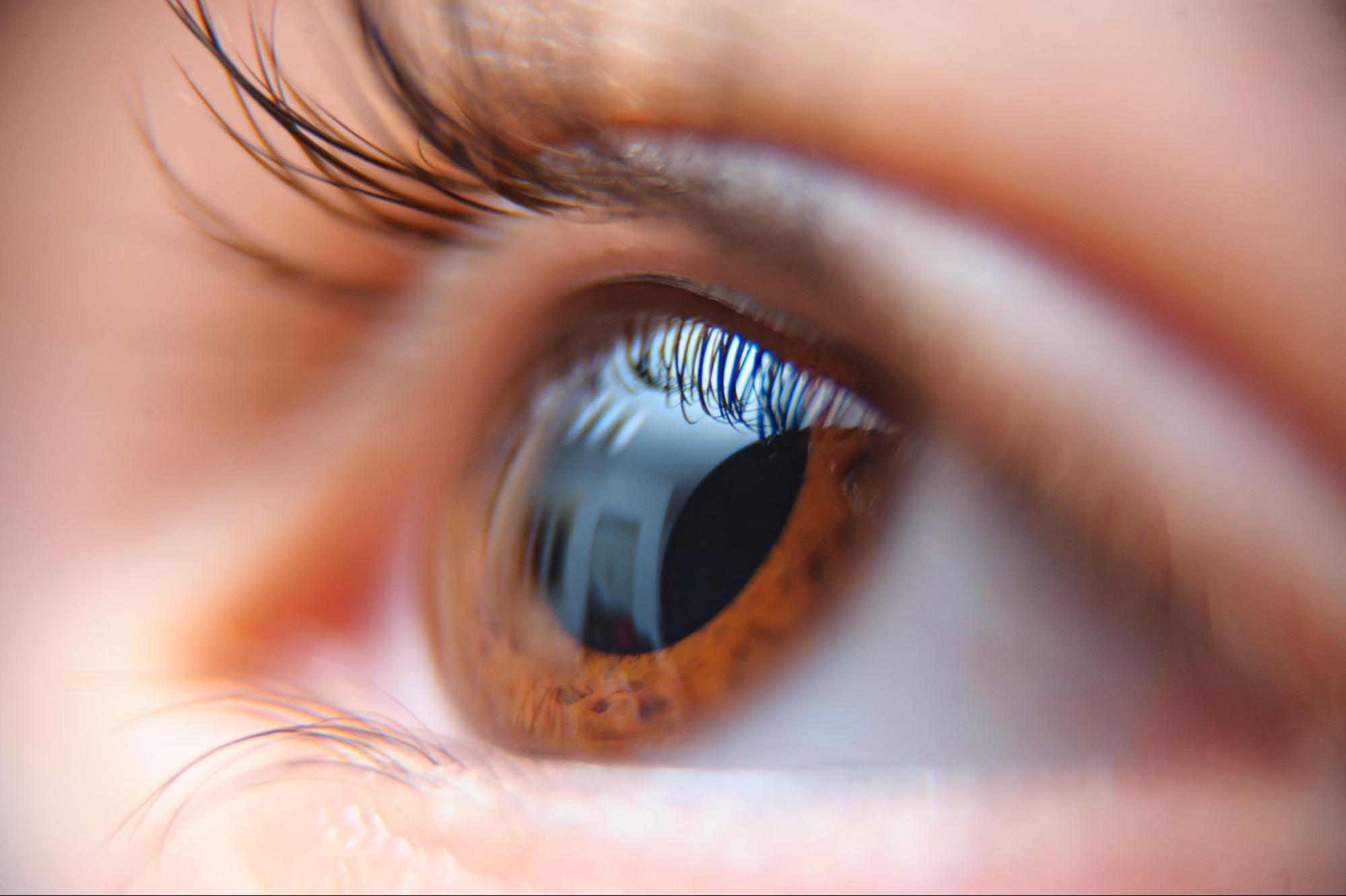 cataract symptoms guide